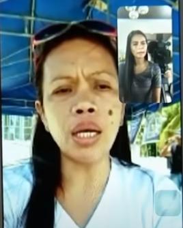 菲律賓醫院誤認傷者患肺炎 疑遭活拔氧氣罩 死後包成木乃伊