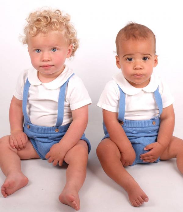 英國夫婦罕誕黑白雙胞胎 二人膚色髮色均不同！出現機率僅百萬分之一