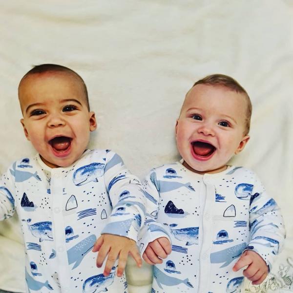 英國夫婦罕誕黑白雙胞胎 二人膚色髮色均不同！出現機率僅百萬分之一