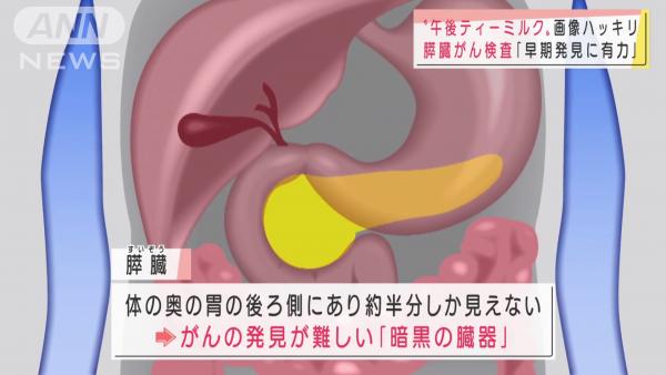 胰臟位於胃部後方，加上早期胰臟癌難以發現，胰臟被日本醫學界稱為「黑暗器官」