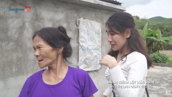 越南女因貌醜求職屢遭拒 整容變美女 聾啞母拒認：這不是我女兒
