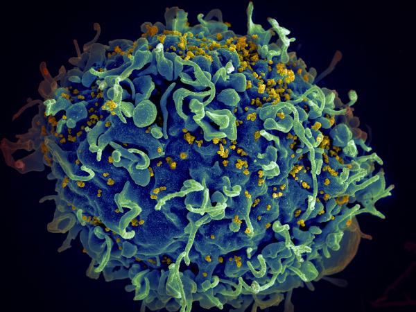 荷蘭發現突變HIV病毒株 傳播速度快2倍！毒性更強！