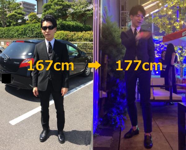 167cm日本醫生花33萬做「骨骼延長手術」 忍痛斷骨增高10cm圓夢變型男！