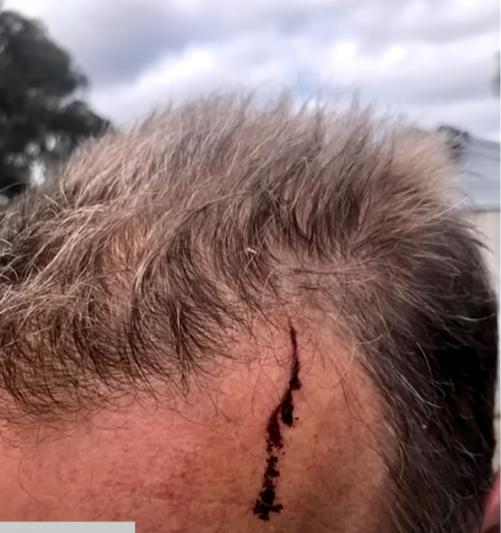澳洲退休拳擊教練與袋鼠「隻揪」 弄得滿身傷痕但1原因堅持不會討厭袋鼠