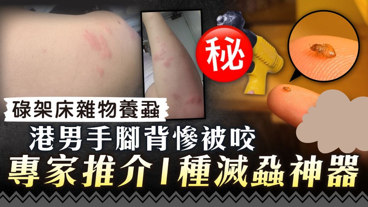 床蝨入屋｜碌架床雜物養蝨 港男手腳背慘被咬 專家推介1種滅蝨神器