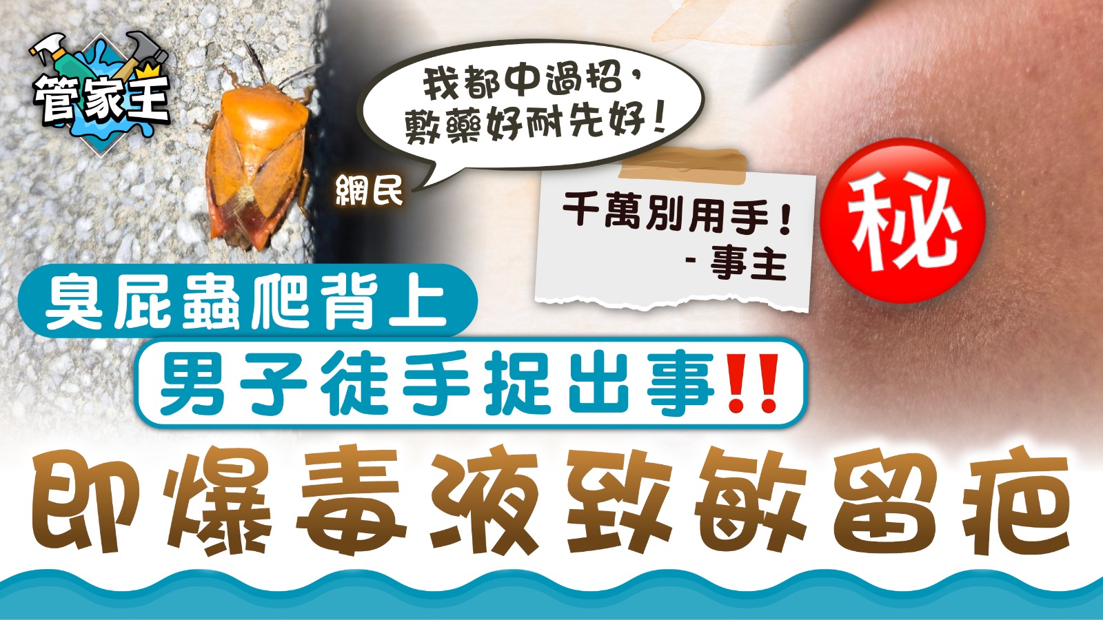 臭屁蟲｜臭屁蟲爬背上男子徒手捉出事 即爆毒液致敏留疤 | UHK 港生活