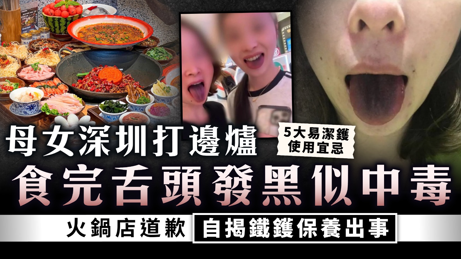 北上注意｜母女深圳打邊爐食完舌頭發黑似中毒 火鍋店道歉自揭鐵鑊保養出事