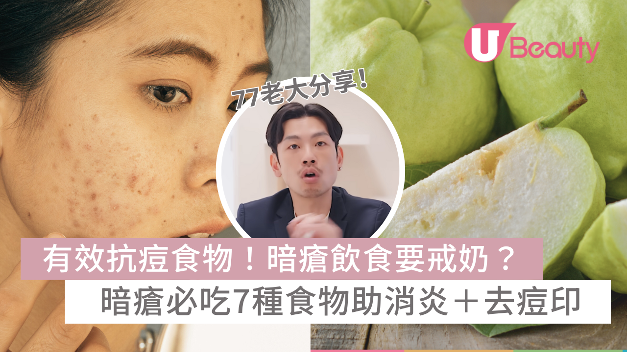 有效抗痘食物！暗瘡飲食要戒奶！暗瘡必吃7種食物助痘痘消炎癒合＋ ...