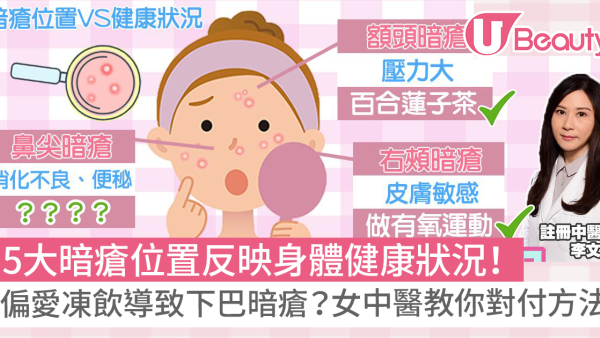 暗瘡位置反映身體隱患！下巴、鼻生瘡代表咩問題？中醫教對應解決暗瘡方法