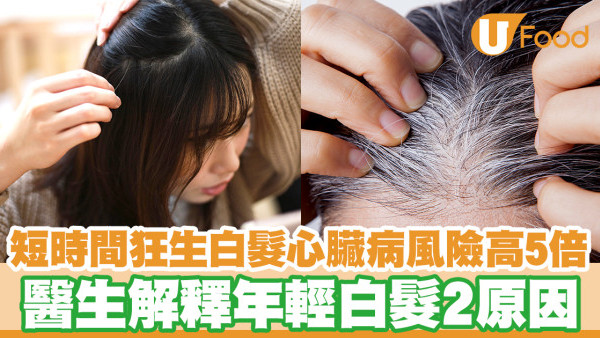 短時間狂生白髮心臟病風險高5倍 醫生解釋年輕白髮2原因／2烏髮食療推介