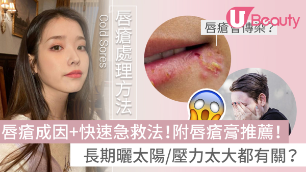 【唇瘡成因+快速急救法2026】附唇瘡膏推薦！長期曬太陽/壓力太大都有關？