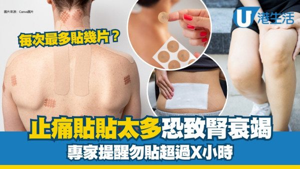 止痛貼副作用︱亂用恐致腎衰竭1成分損爛皮膚？專家提勿貼超過多少小時