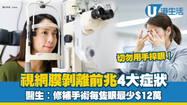 古天樂患飛蚊症視網膜穿窿！視網膜剝離先兆4症狀！修補手術每隻眼$12萬起