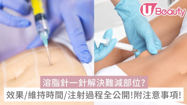 溶脂針一針解決難減部位？效果/維持時間/注射過程公開！附費用及注意事項