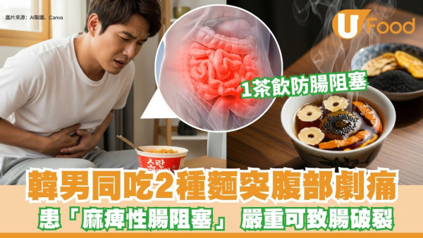 韓男腹劇痛「麻痺性腸阻塞」因同時間吃2款麵！中醫教1茶飲防腸塞