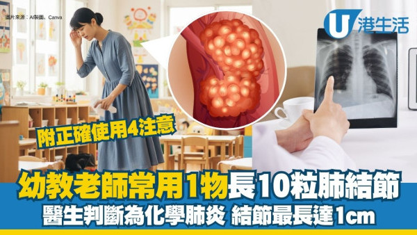 幼兒園老師工作常用漂白水 驚現10粒肺結節！專家教漂白水使用4注意