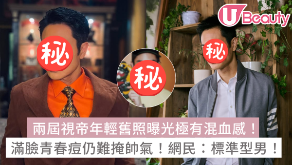 鄭嘉穎年輕舊照曝光極有混血感！滿臉青春痘仍難掩帥氣！網民：名副其實標準型男！