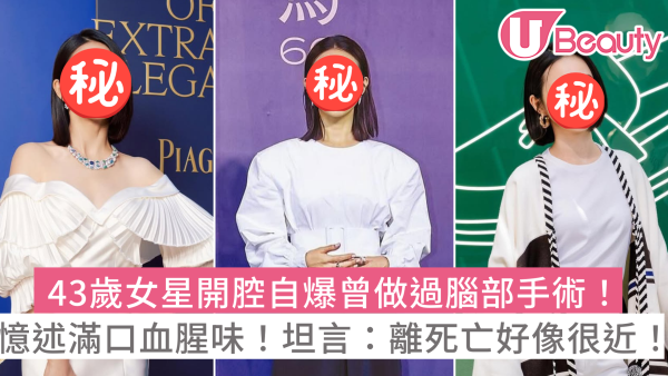 林依晨開腔自爆曾做過腦部手術！憶述術後滿口血腥味！坦言：離死亡好像很近！