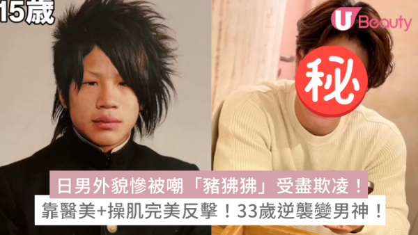 日男外貌慘被嘲「豬狒狒」受盡欺凌！ 靠醫美+操肌完美反擊！33歲逆襲變男神！