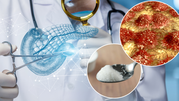 日本研究揭1款代糖可有力助抗癌！誘導胰臟癌細胞死亡／食物安全中心:天然又安全