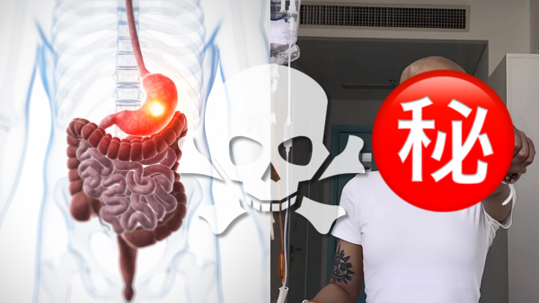 25歲KOL胃癌離世  生前愛咖啡汽水常熬夜／醫生警告6類高危人士需定期胃鏡檢查