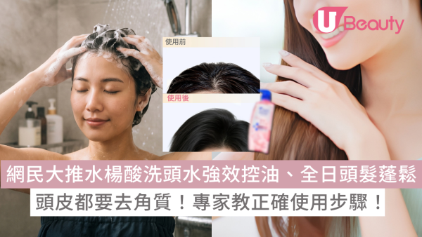 頭皮都要去角質？網民大推$89水楊酸洗頭水強效控油、全日頭髮蓬鬆！專家教正確使用步驟
