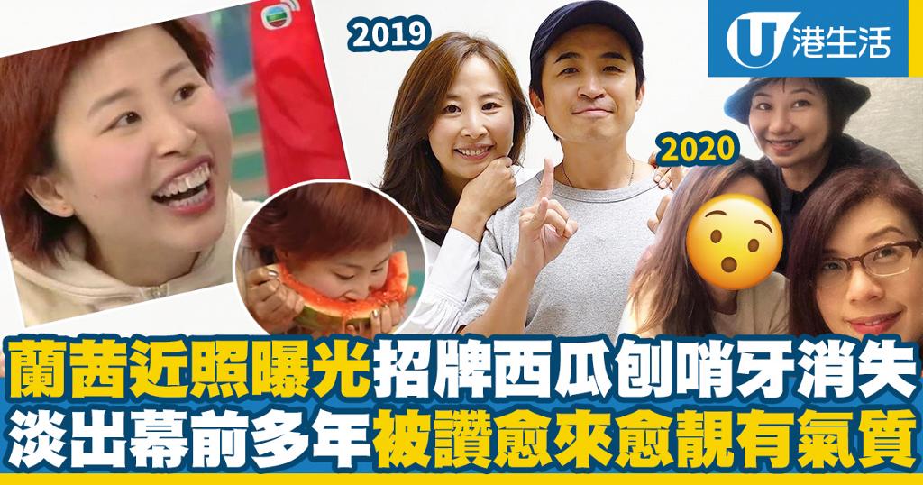 蘭茜近照曝光招牌「西瓜刨」哨牙消失 淡出幕前多年被網民讚愈來愈靚有氣質 | UHK 港生活