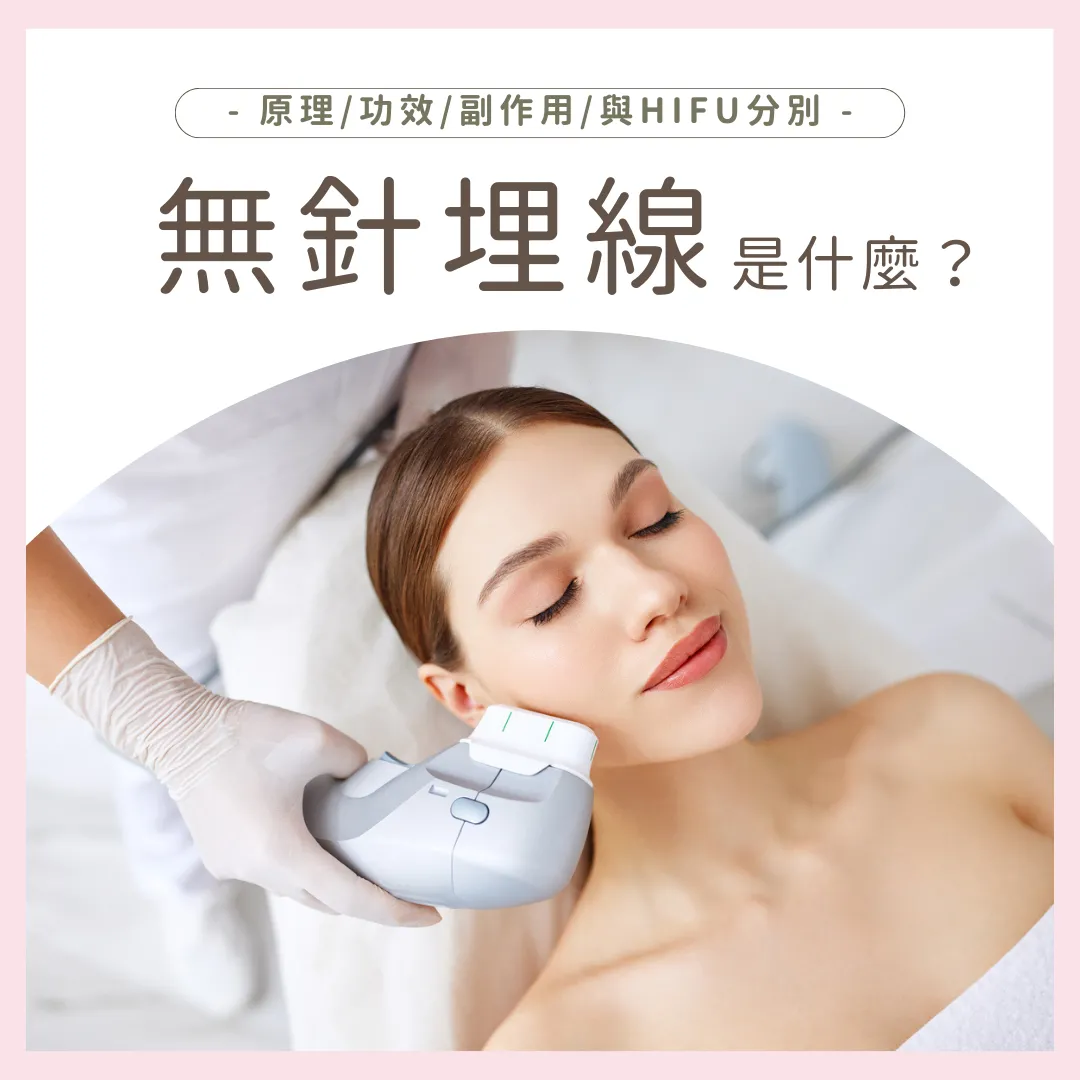 無針埋線是什麼？解構無針埋線原理/功效/副作用/與HIFU分別