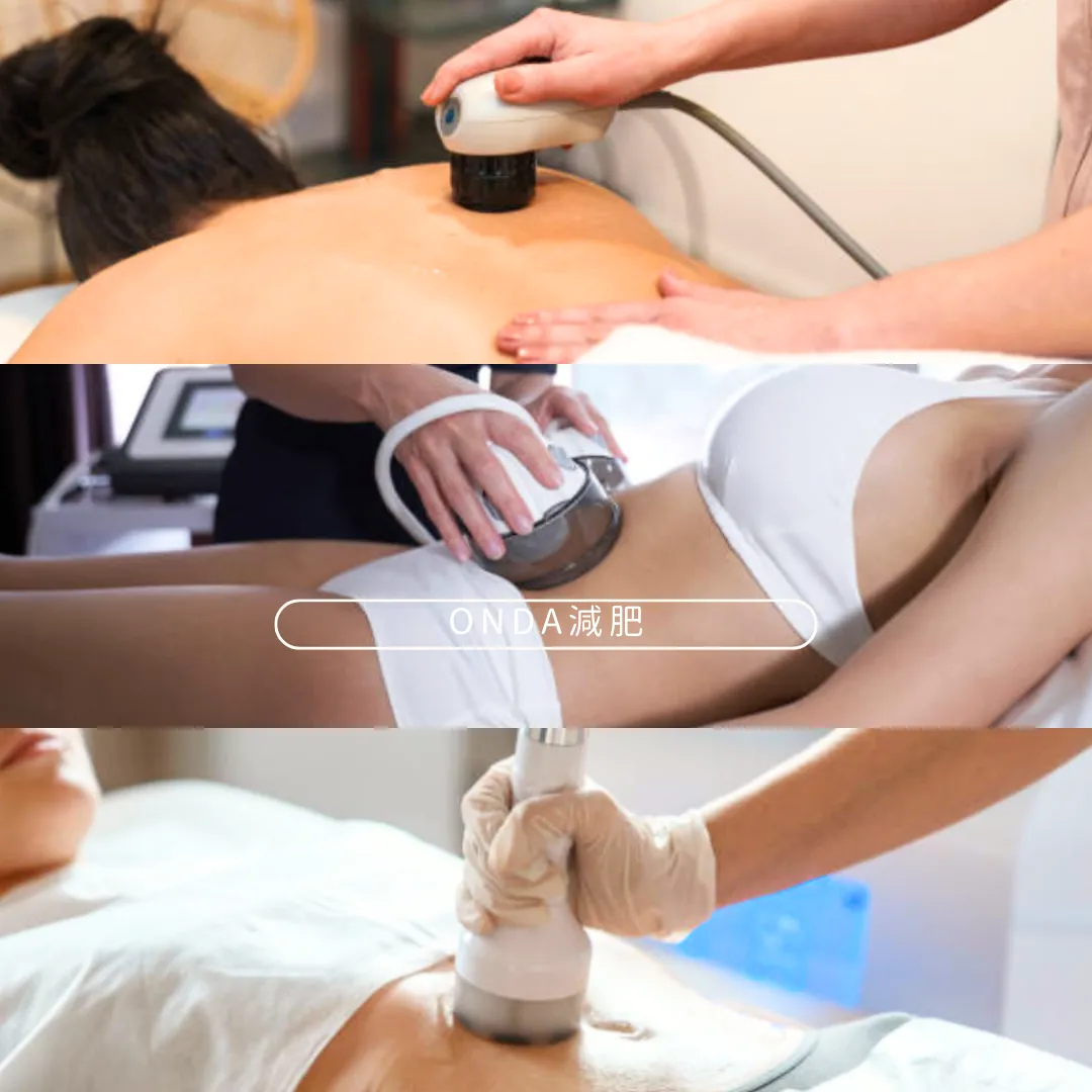 Onda減肥｜Onda溶脂有用嗎？原理/功效/副作用解構！誰適合做vs誰不適合？