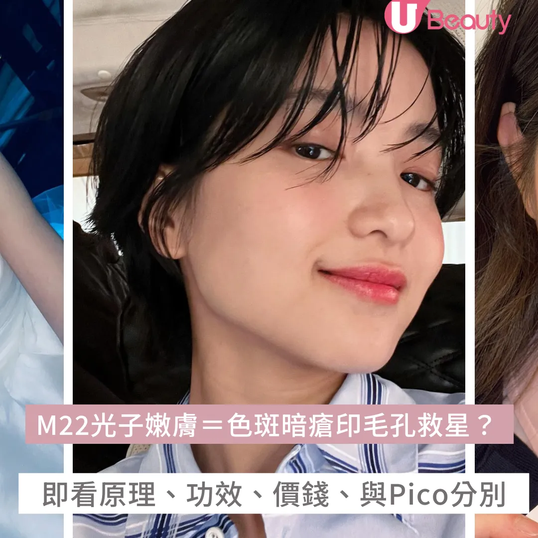 M22光子嫩膚＝色斑暗瘡印、毛孔救星？一文看清原理、功效、價錢及與Pico分別