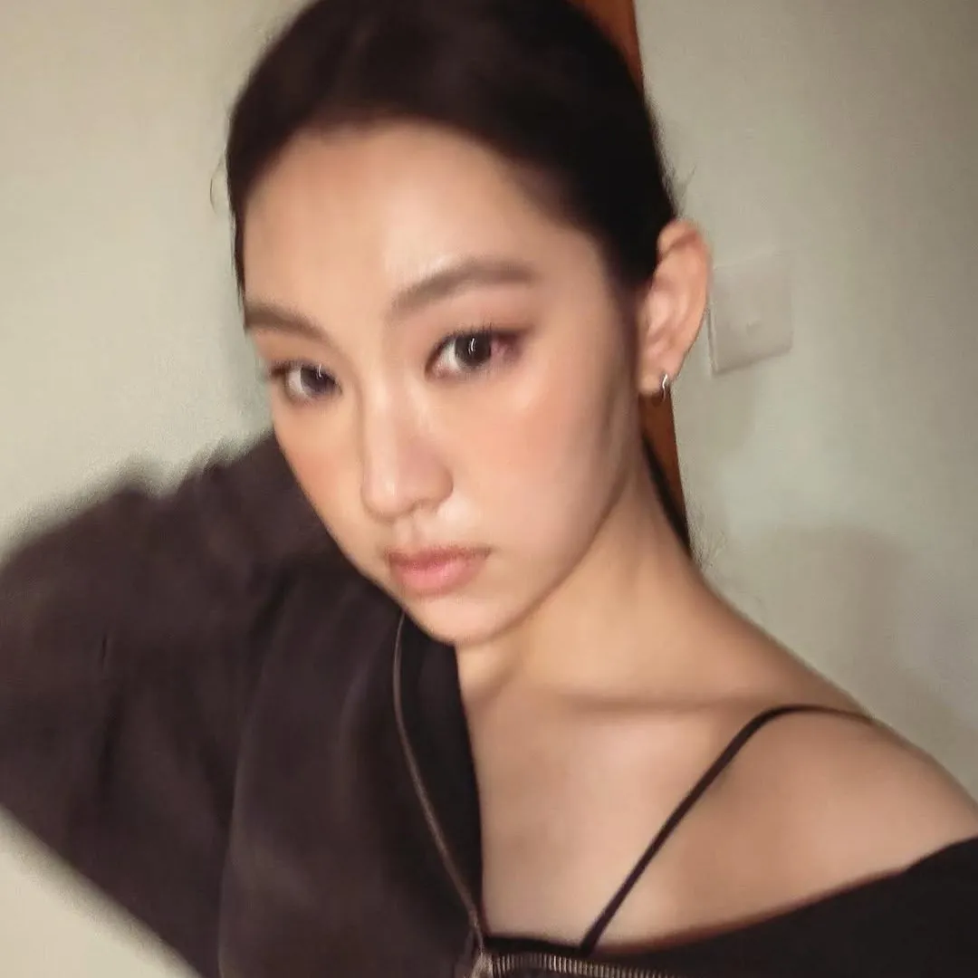 炎明熹臉上一位置受傷意外成焦點？！新造型被批極顯老態！網民評價兩極！