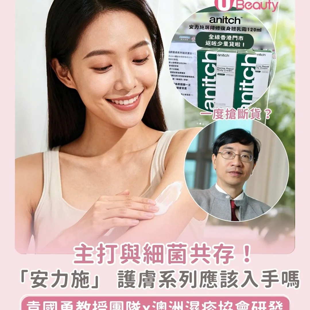 濕疹藥膏推薦｜袁國勇教授團隊研發「安力施Anitch」不用類固醇/抗生素亦可醫濕疹！