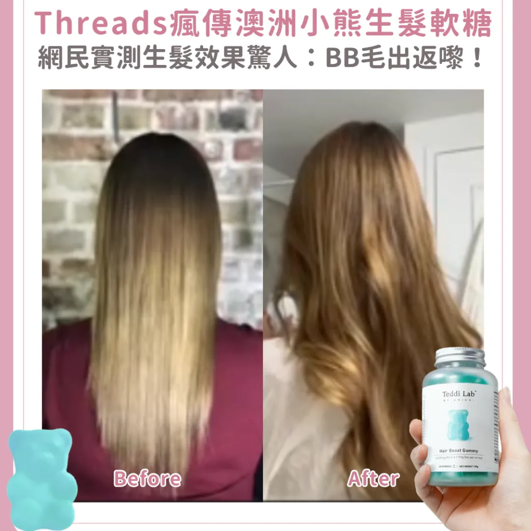 脫髮救星？Threads瘋傳澳洲 Unichi 小熊軟糖！網民實測生髮效果驚人：「BB毛出返嚟」