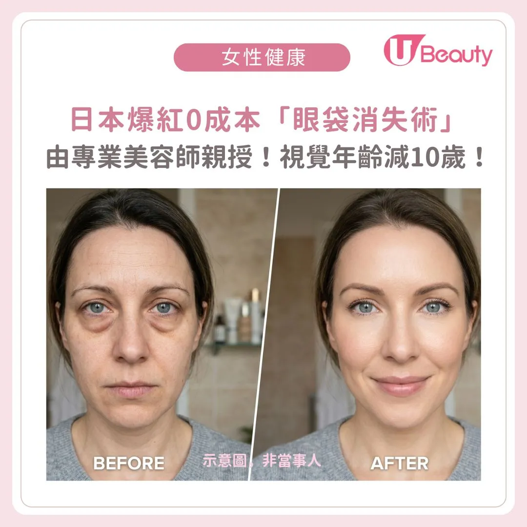 日本爆紅0成本「眼袋消失術」！專業美容師親授日式提肌操！視覺年齡減10歲！
