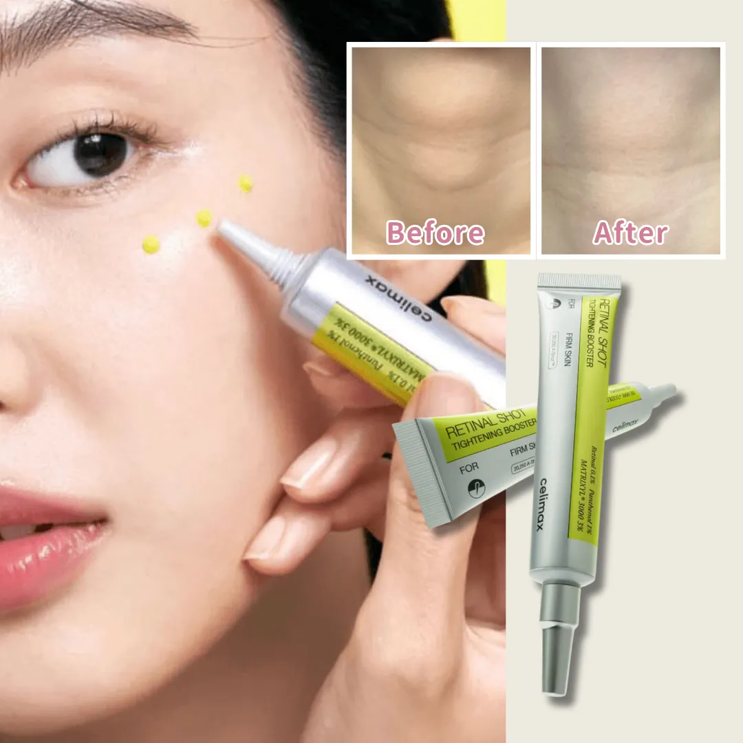 網民狂推Olive Young「平民美白精華」 不用HK$200大讚：改善腋下/手肘暗沉！用完白2度！？