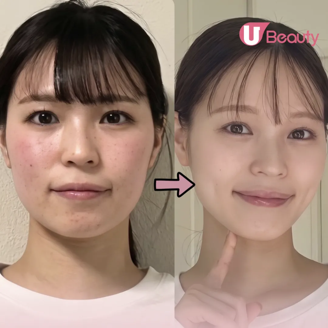 日本爆紅 「6分鐘最強瘦面法」！600萬人觀看！減走Baby Fat、消水腫！