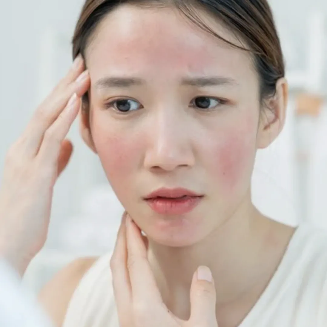 換季皮膚過敏、眼睛乾癢、鼻敏感怎麼辦？日本皮膚科及呼吸道專科醫生教舒緩修護對策！
