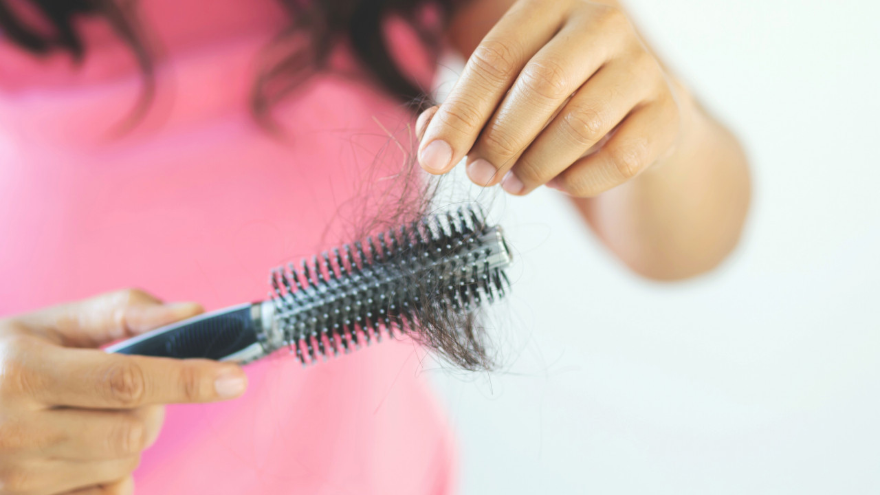 25歲女極端減肥導致脫髮 戒碳水令頭髮甩到見頭皮