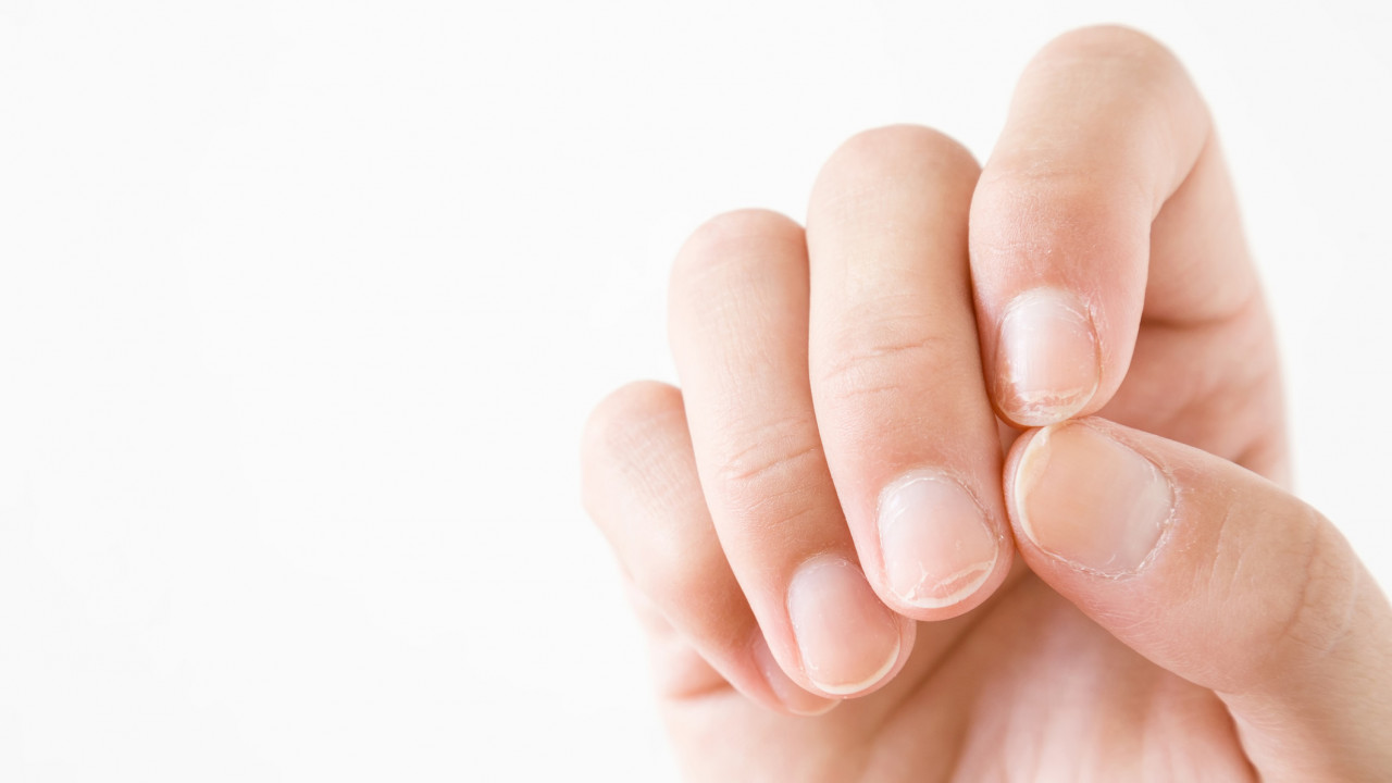 指甲無月牙代表什麼？ 中西醫解釋指甲與健康的關係／附食材推介