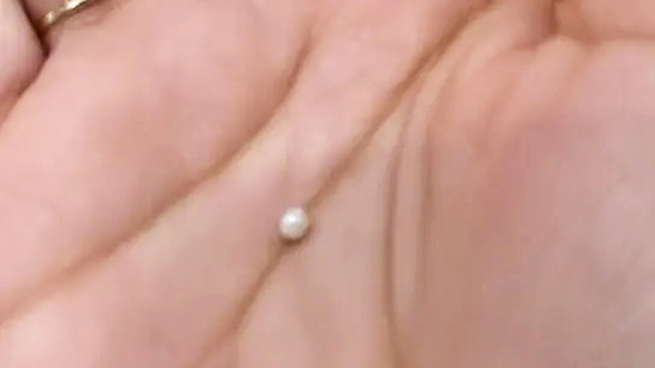 女子食生蠔意外發現珍珠 市價估值逾數千美元