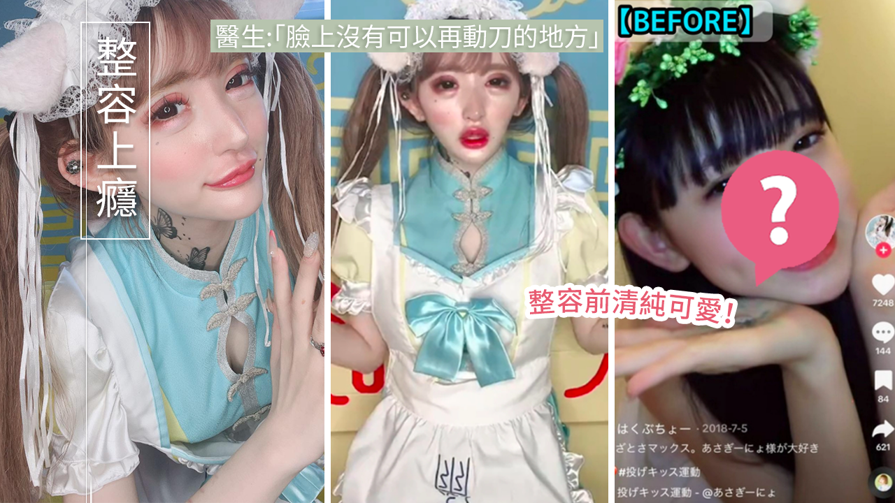 日本18歲少女豪擲9百萬整容換臉！五官僵硬面目全非！整容前照片震驚網民！