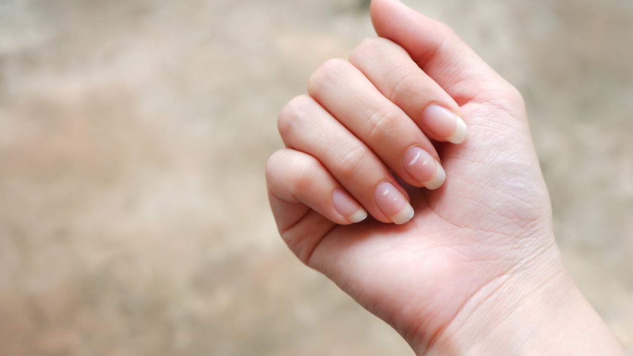 指甲有白色橫紋代表什麼？　營養師分析5大指甲問題／營養補充