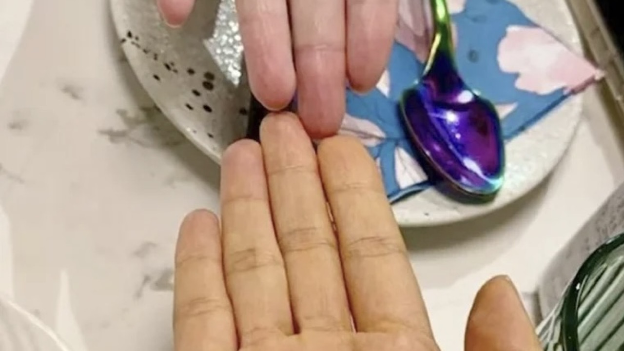 為減肥連食三個月紅蘿蔔 女子皮膚變色慘成「橙色人」