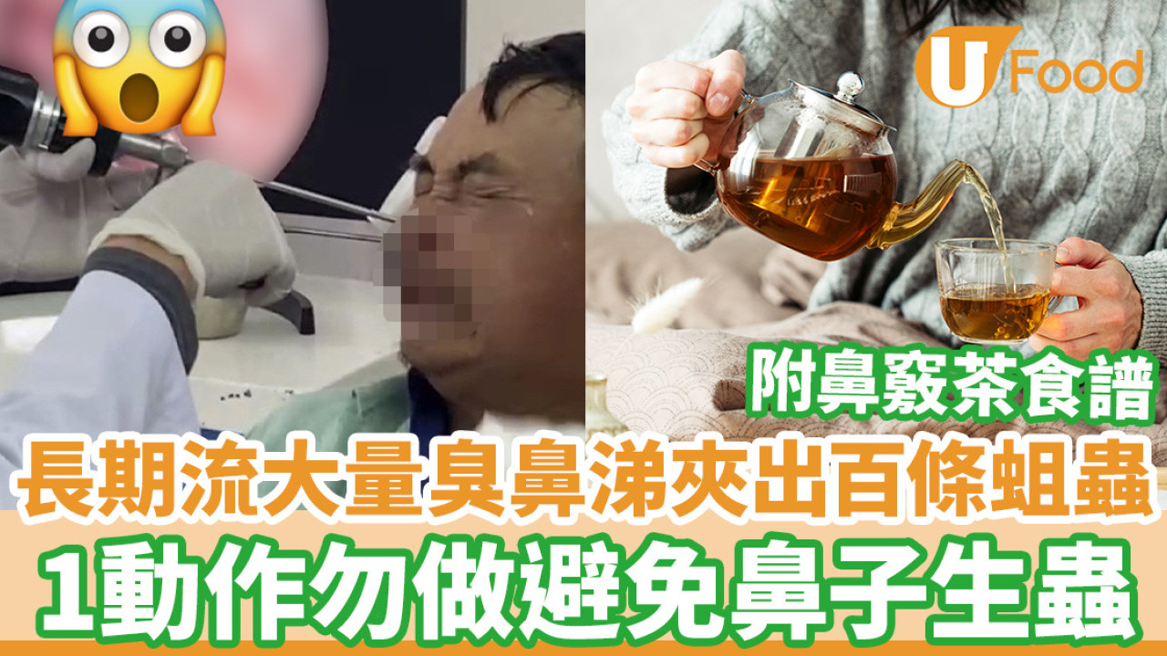 長期流大量臭鼻涕夾出100條蛆蟲 1動作勿做避免鼻腔生蟲／附鼻竅茶食譜