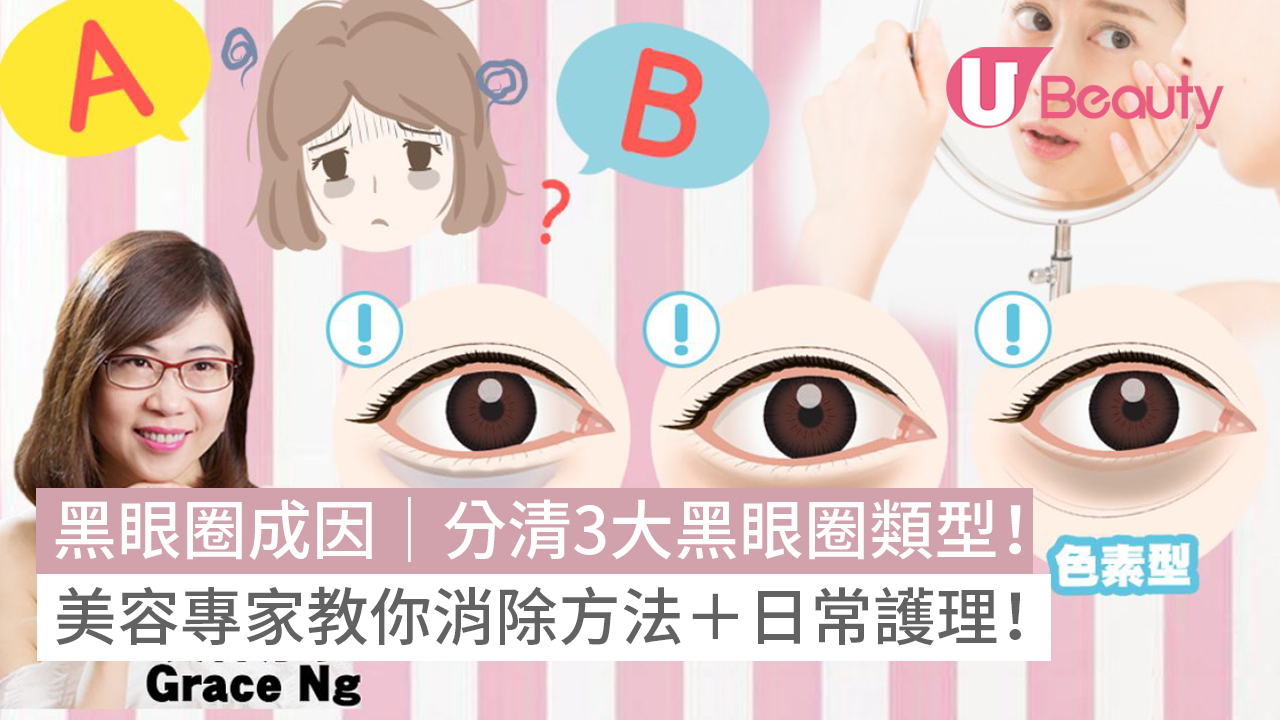 黑眼圈成因｜專家教你消除改善護理方法！認清3大黑眼圈類型！