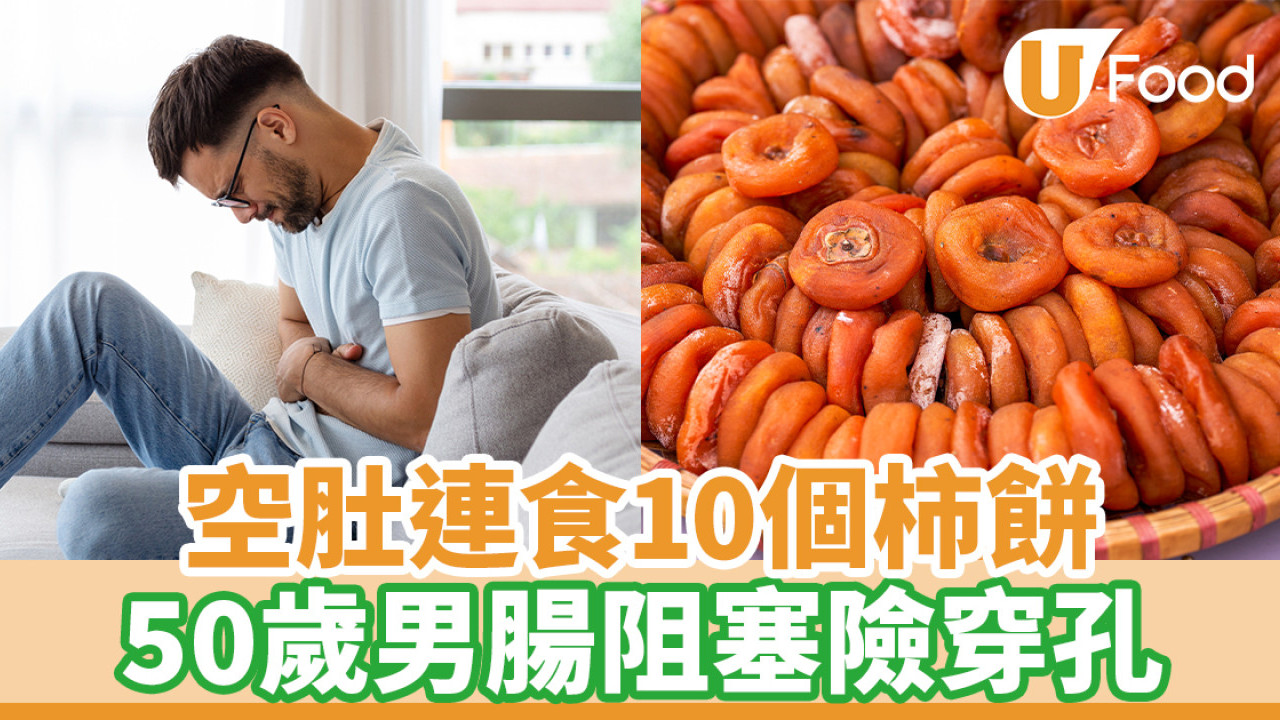 空肚連食10個柿餅 50歲男腸阻塞險穿孔