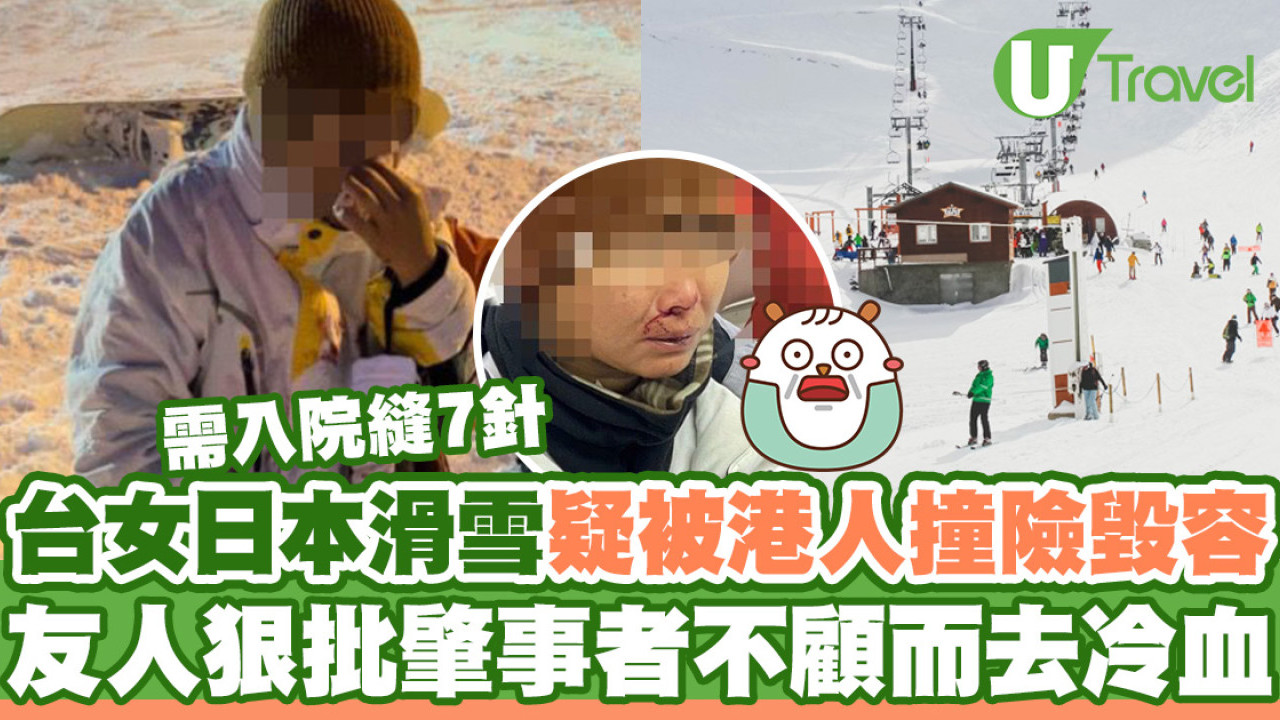 滑雪意外｜台女日本滑雪疑被港女撞傷縫7針險毀容  友人發文狠批肇事者不顧而去冷血