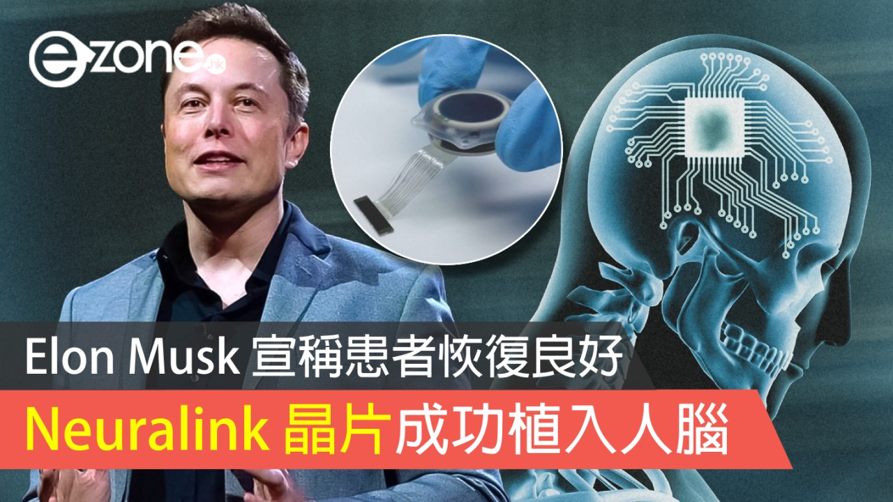Elon Musk 表示 Neuralink 晶片成功植入人腦 宣稱患者恢復良好