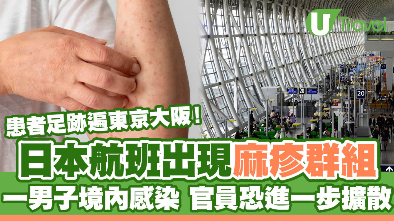 日本航班爆發麻疹群組 患者足跡遍東京大阪！一男子境內感染 官員恐進一步擴散