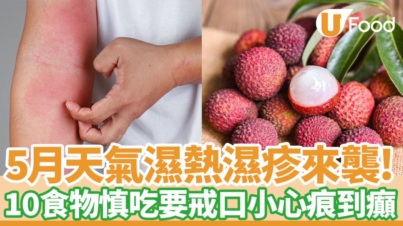濕疹戒口｜五月天氣濕熱落雨濕疹來襲！營養師提10類食物忌吃小心癢到心慌